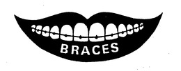 BRACES