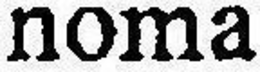 NOMA
